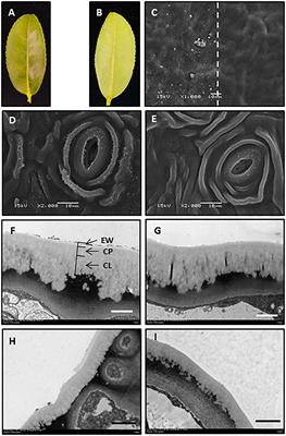 A Proposed Method for Simultaneous Measurement of Cuticular Transpiration From Different Leaf Surfaces in <mark class="highlighted">Camellia sinensis</mark>